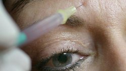 Nicht zuletzt dank der "injizierbaren Kosmetik", also den zahlreichen Botox-Produkten, hat Galderma in neun Monaten mehr Umsatz geschrieben. (Archivbild)