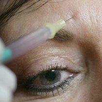 Nicht zuletzt dank der "injizierbaren Kosmetik", also den zahlreichen Botox-Produkten, hat Galderma in neun Monaten mehr Umsatz geschrieben. (Archivbild)