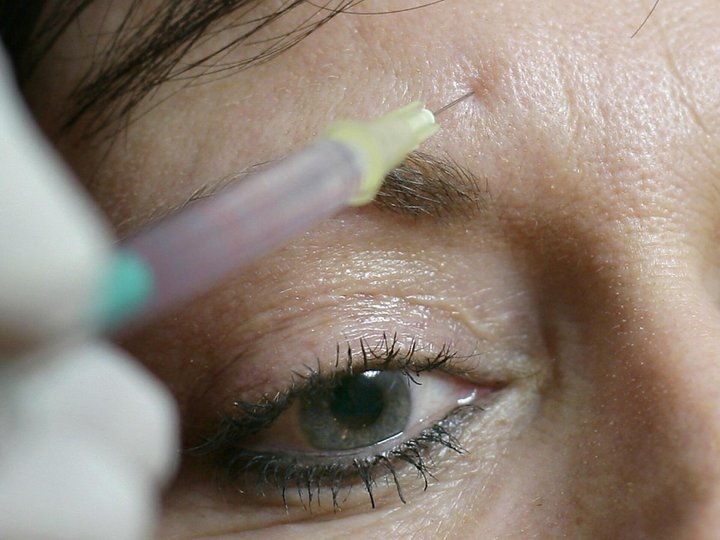 Nicht zuletzt dank der "injizierbaren Kosmetik", also den zahlreichen Botox-Produkten, hat Galderma in neun Monaten mehr Umsatz geschrieben. (Archivbild)